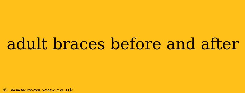 adult braces before and after