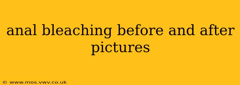 anal bleaching before and after pictures