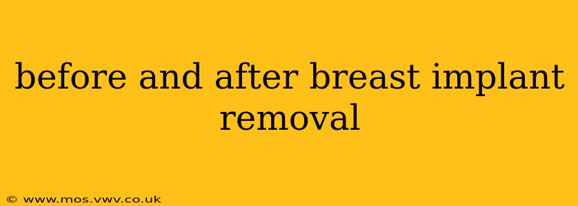 before and after breast implant removal