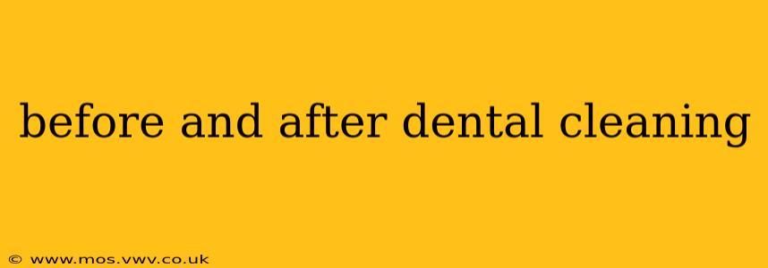 before and after dental cleaning