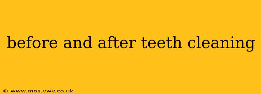 before and after teeth cleaning
