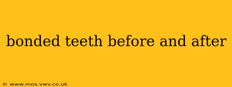 bonded teeth before and after