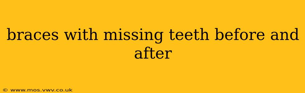 braces with missing teeth before and after