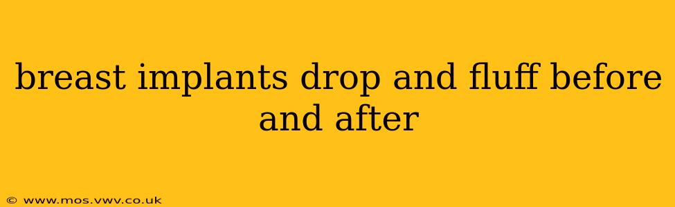 breast implants drop and fluff before and after