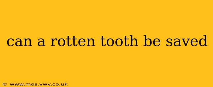 can a rotten tooth be saved