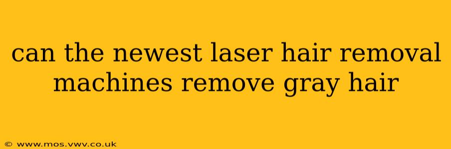 can the newest laser hair removal machines remove gray hair