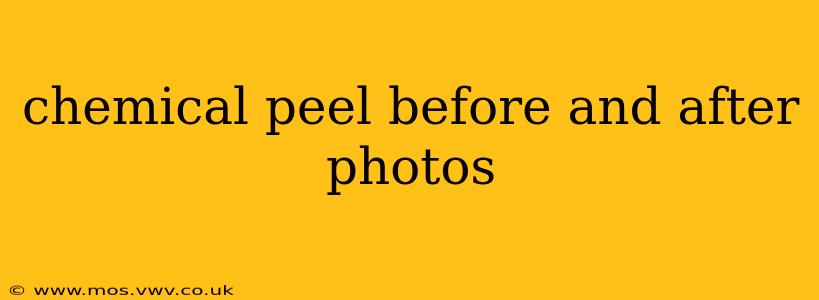 chemical peel before and after photos