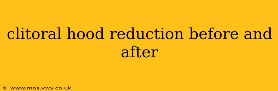 clitoral hood reduction before and after