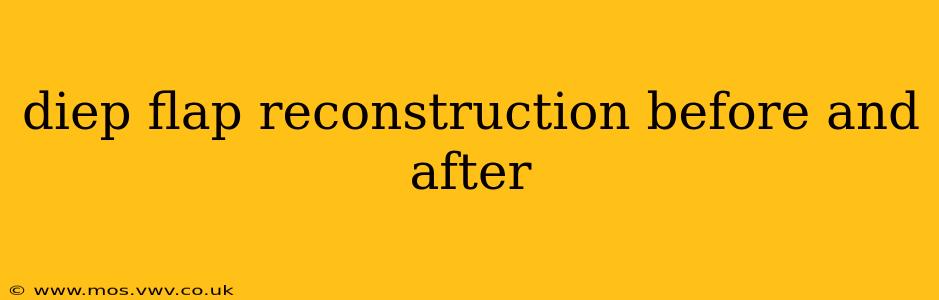 diep flap reconstruction before and after