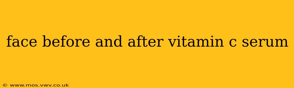 face before and after vitamin c serum