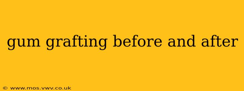 gum grafting before and after