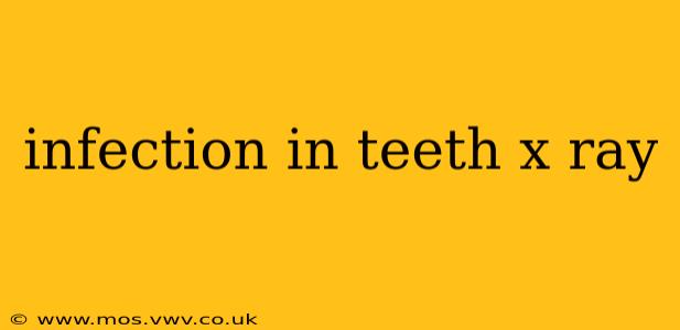 infection in teeth x ray