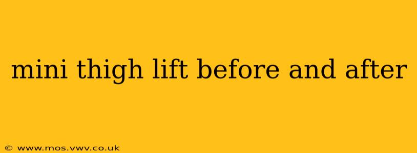 mini thigh lift before and after