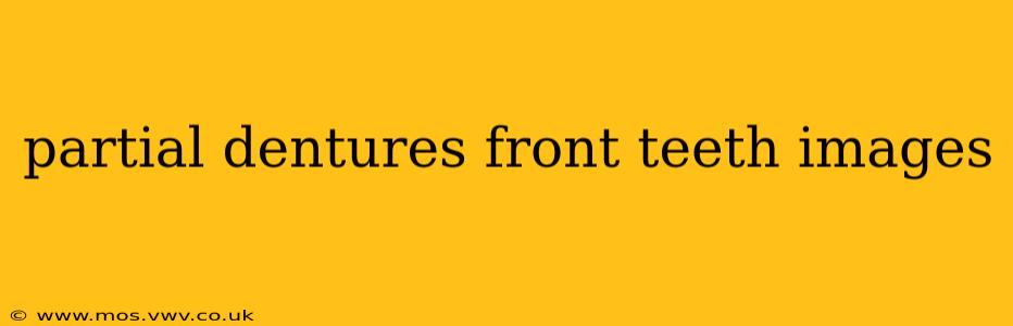 partial dentures front teeth images