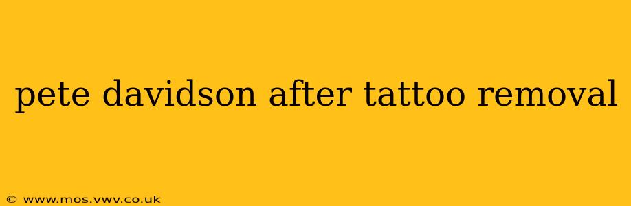 pete davidson after tattoo removal