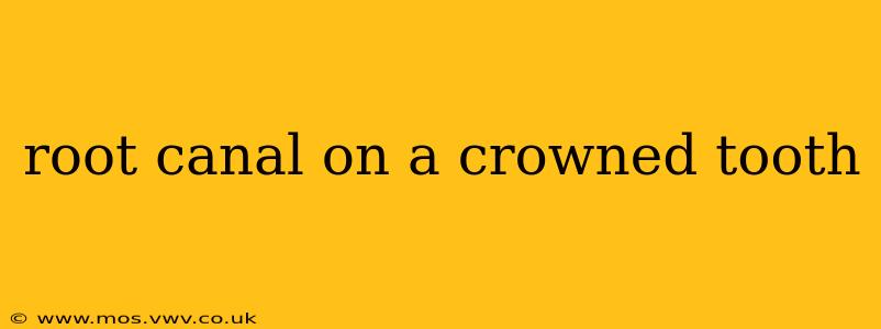 root canal on a crowned tooth