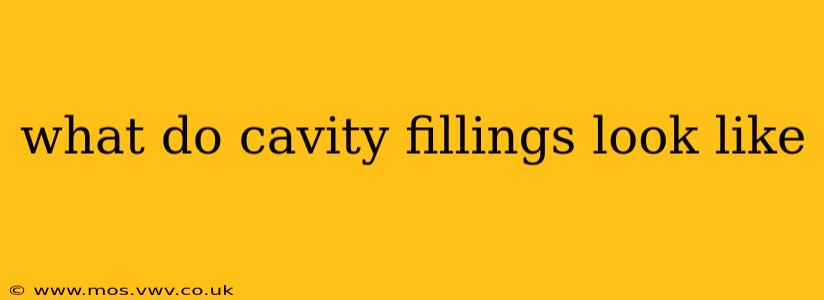what do cavity fillings look like