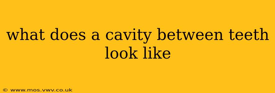 what does a cavity between teeth look like