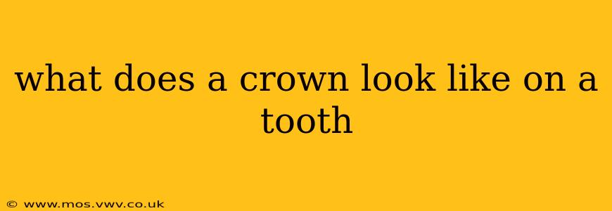 what does a crown look like on a tooth