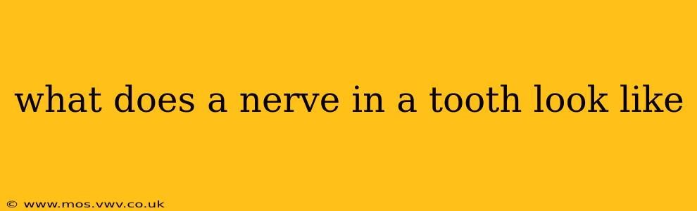 what does a nerve in a tooth look like