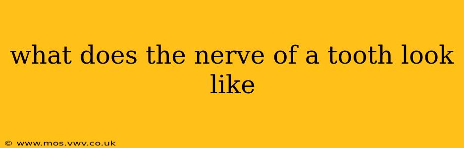 what does the nerve of a tooth look like