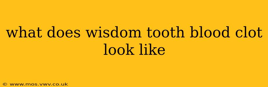 what does wisdom tooth blood clot look like