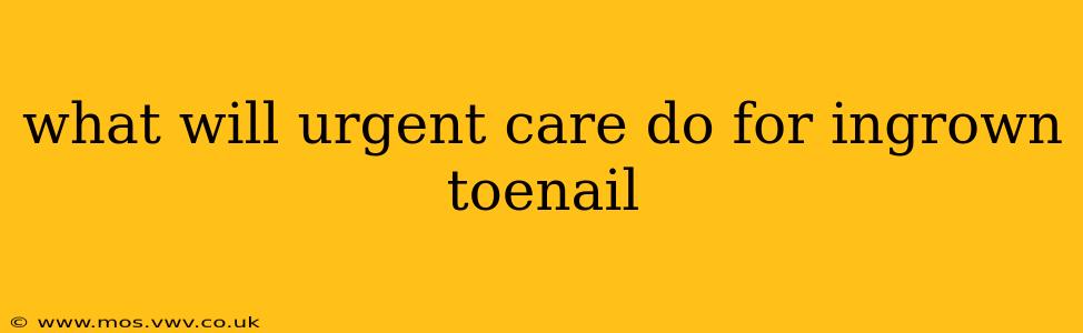 what will urgent care do for ingrown toenail