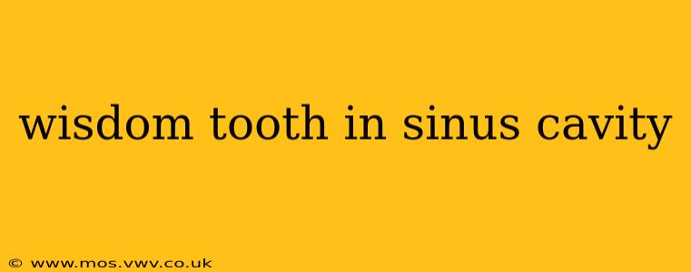 wisdom tooth in sinus cavity