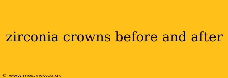 zirconia crowns before and after